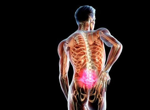 Від болю в спині страждає 70% населення планети