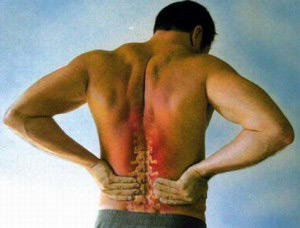 Основною причиною болю навколо попереку може бути остеохондроз