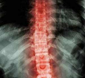 normal human's thoracic-lumbar spine