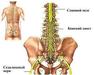 sindrom-konskogo-hvosta