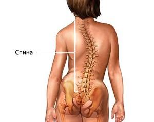 Сколіоз - це захворювання, яке порушує роботу інших органів